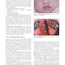 دانلود کتاب Oral and Maxillofacial Pathology