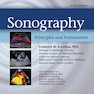 دانلود کتاب Sonography Principles and Instruments