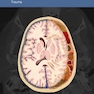 دانلود کتاب Osborn’s Brain, 2nd Edition2017 آزبورن مغز