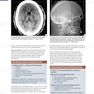 دانلود کتاب Osborn’s Brain, 2nd Edition2017 آزبورن مغز