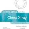 دانلود کتاب Making Sense of the Chest X-ray: A hands-on guide, 2nd Edition2013 س ... 