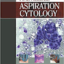 دانلود کتاب Atlas of Fine Needle Aspiration Cytology