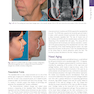 دانلود کتاب Cosmetic Facial Surgery 2nd Edicion