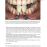 دانلود کتاب Practical Procedures in Aesthetic Dentistry