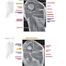 دانلود کتاب Sectional Anatomy by MRI and CT