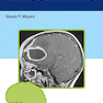 دانلود کتاب Differential Diagnosis in Neuroimaging: Brain and Meninges