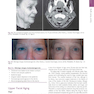 دانلود کتاب The Art and Science of Facelift Surgery: A Video Atlas 1st Edicion 2 ... 