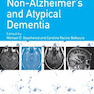 دانلود کتاب Non-Alzheimer