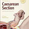 دانلود کتاب Textbook of Caesarean Section