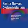 دانلود کتاب Central Nervous System Metastases متاستازهای سیستم عصبی مرکزی