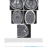 دانلود کتاب Duke Review of MRI Physics: Case Review Series