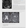 دانلود کتاب Duke Review of MRI Physics: Case Review Series