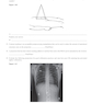دانلود کتاب Workbook for Radiographic Image Analysis 5th Edicion