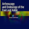 دانلود کتاب Arthroscopy and Endoscopy of the Foot and Ankle : Principle and Prac ... 