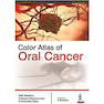 دانلود کتاب Color Atlas of Oral Cancer