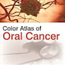 دانلود کتاب Color Atlas of Oral Cancer