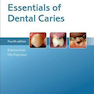 دانلود کتاب Essentials of Dental Caries