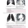 دانلود کتاب Core Radiology: A Visual Approach to Diagnostic Imaging 1st Edition  ... 