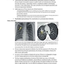دانلود کتاب Core Radiology: A Visual Approach to Diagnostic Imaging 1st Edition  ... 