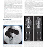 دانلود کتاب Learning Radiology: Recognizing the Basics 4th Edition