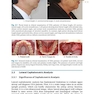 دانلود کتاب  Orthodontics in Obstructive Sleep Apnea Patients: A Guide to Diagno ... 