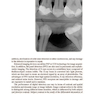 دانلود کتاب Digital Restorative Dentistry: A Guide to Materials, Equipment, and  ... 