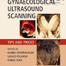 دانلود کتاب Gynaecological Ultrasound Scanning: Tips and Tricks 1st Edition 2020
