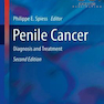 دانلود کتاب Penile Cancer: Diagnosis and Treatment, 2nd Edition2016 سرطان آلت تن ... 