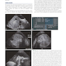 دانلود کتاب Callen’s Ultrasonography in Obstetrics and Gynecology, 6th Edition
