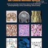 دانلود کتاب Classification of Tumours of the Central Nervous System, 4th Edition ... 