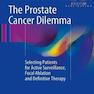 دانلود کتاب The Prostate Cancer Dilemma: Selecting Patients for Active Surveilla ... 