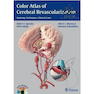 دانلود کتاب Color Atlas of Cerebral Revascularization: Anatomy, Techniques, Clin ... 