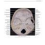 دانلود کتاب Rhoton’s Atlas of Head, Neck, and Brain