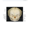 دانلود کتاب Rhoton’s Atlas of Head, Neck, and Brain
