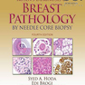 دانلود کتاب Rosen’s Diagnosis of Breast Pathology by Needle Core Biopsy 4th Edit ... 