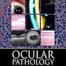 دانلود کتاب Ocular Pathology, 7th Edition2014 آسیب شناسی چشم