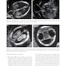 دانلود کتاب Ultrasound of Congenital Fetal Anomalies 2nd Edition2014