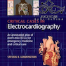 دانلود کتاب Critical Cases in Electrocardiography, 1st Edition2020 موارد بحرانی  ... 