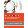 دانلود کتاب PET/CT in Cancer: An Interdisciplinary Approach to Individualized Im ... 