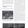 دانلود کتاب Fundamentals of Musculoskeletal Ultrasound 3rd Edition 2017