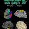 دانلود کتاب Invasive Studies of the Human Epileptic Brain2019 مطالعات تهاجمی مغز ... 