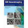 دانلود کتاب MR Neuroimaging: Brain, Spine, and Peripheral Nerves 1st Edition207  ... 