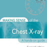 دانلود کتاب Making Sense of the Chest X-ray: A hands-on guide, 2nd Edition2013 س ... 