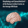 دانلود کتاب Atlas of the Morphology of the Human Cerebral Cortex on the Average  ... 