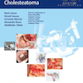 دانلود کتاب Microsurgical Management of Middle Ear and Petrous Bone Cholesteatom ... 