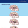 دانلود کتاب The Glioma PDF 1st Edition2020 گلیوما