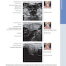 دانلود کتاب Diagnostic Ultrasound: Head and Neck 2nd Edition2019