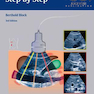 دانلود کتاب Abdominal Ultrasound: Step by Step 3rd Edition2015 سونوگرافی شکمی