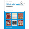 دانلود کتاب Clinical Cases in Periodontics (Clinical Cases (Dentistry) PDF 42) 1 ... 