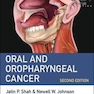 دانلود کتاب Oral and Oropharyngeal Cancer 2nd Edition2018 سرطان دهان و حلق
